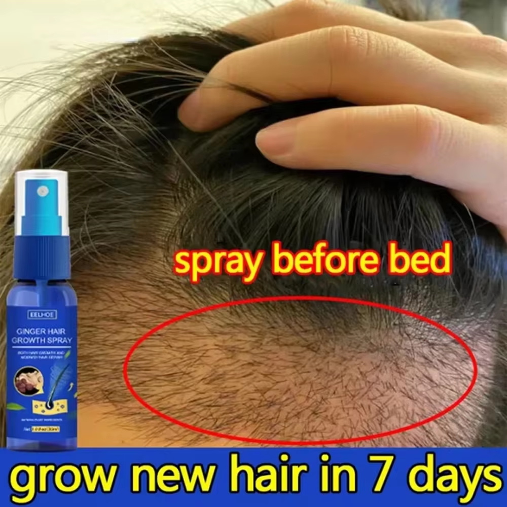 Hair Care Natural - 速効性ジンジャーヘアグローススプレー、毛根育成、脱毛防止、育毛セラム、頭皮ダメージ修復、栄養ケア製品、女性男性用