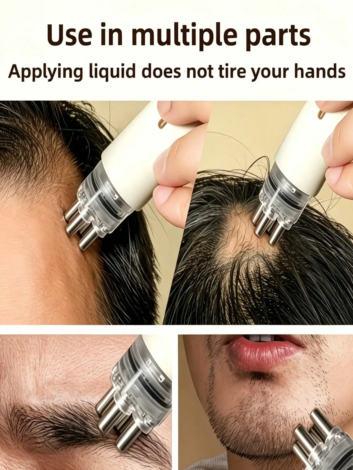 Hair Care For Hair Growth - 頭皮アプリケーター トラベルキャパシティヘアグロースセラムガイドコームローラーボールアプリケーター、ポータブル頭皮アプリケーターコーム、速度調整可能なヘアケアマッサージコーム、頭皮マッサージツール、頭皮を滑らかにする、プロのヘアスタイリングツール、適切なツール