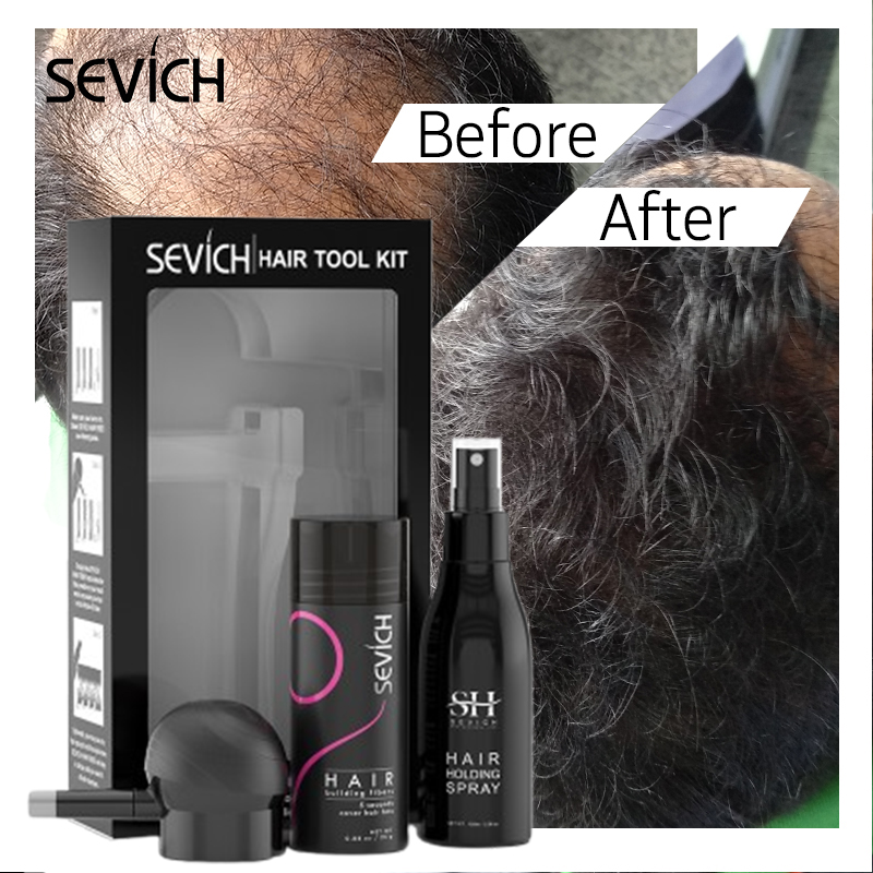 黒髪繊維セット 育毛繊維 ケラチン増毛スプレー 育毛繊維 脱 - Keratin Treatment Set のレビューと価格